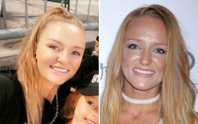 maci before and after botox