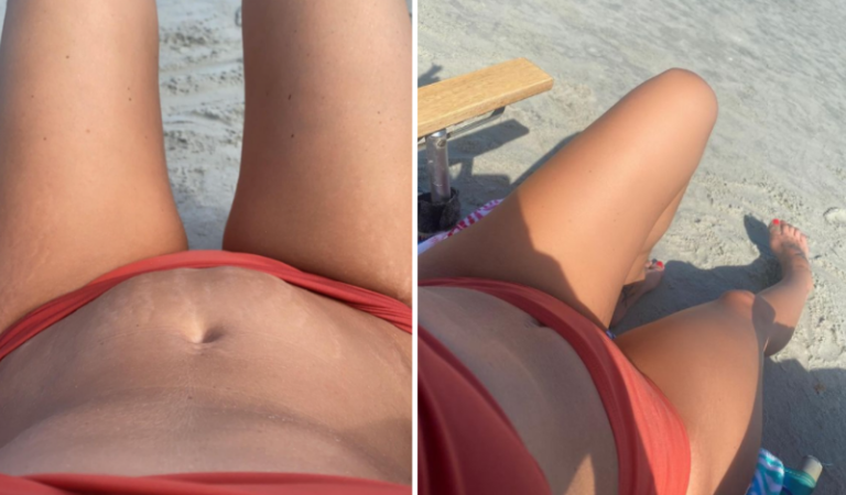 Teen Mom Star Leah Messer Shares Pics Of Her Stretch Marks For Fans