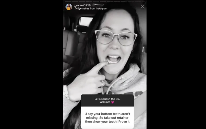 Jenelle teeth instagram