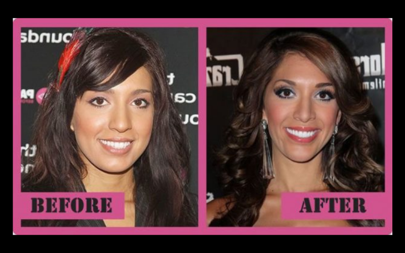 Farrah before and after