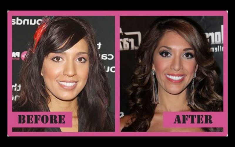 Farrah Abraham Has Had So Much Plastic Surgery Her Phone Thinks She S 9 Different People